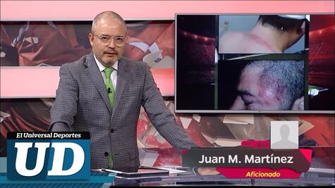 Testimonio del aficionado que fue brutalmente golpeado por seguridad del estadio de Chivas