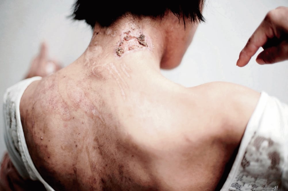 Maltrato. Leticia y su familia golpeaban a la joven hasta hacerla sangrar, luego le arrancaban las costras (ARCHIVO. EL UNIVERSAL)