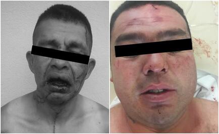 Policías se enfrentan a balazos con 2 presuntos ladrones en Ecatepec