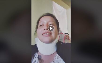 Monserrat denuncia violencia de su expareja sentimental en Edomex