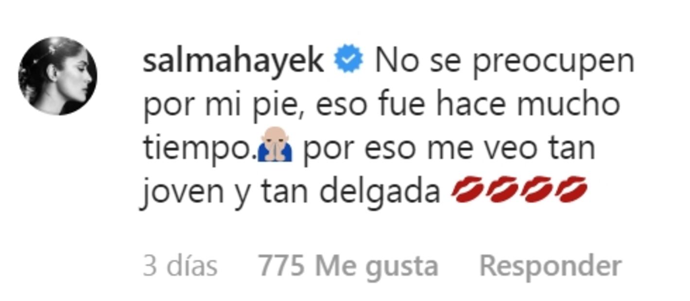 Salma Hayek preocupa a sus fans por su pierna