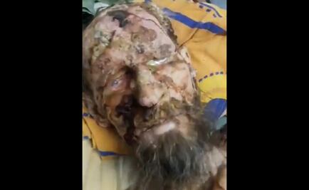 Fake News: la historia de un hombre supuestamente atacado por un oso en Rusia