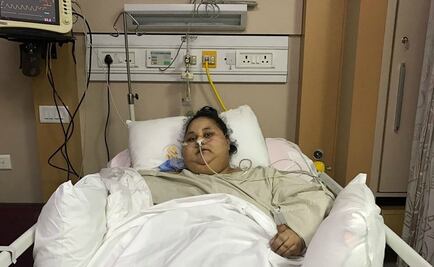 Egipcia de 500 kilos se recupera tras cirugía para bajar de peso