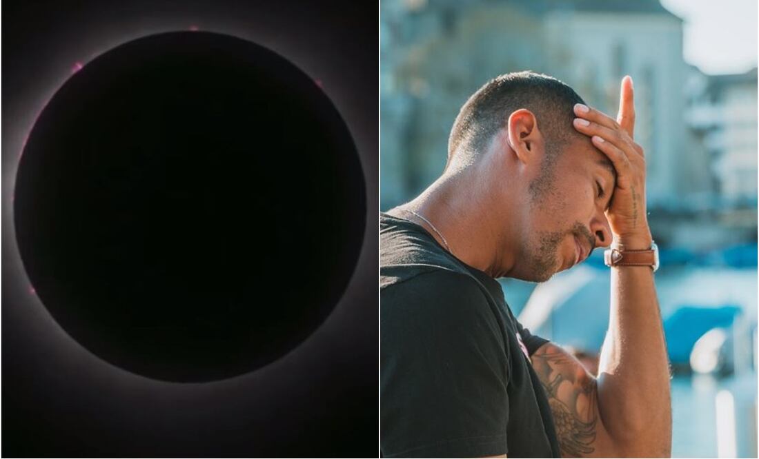 Dolor de cabeza después de ver el eclipse total.
Foto: Captura de pantalla