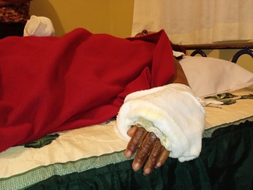 Olivia, mujer quemada con aceite, quiere que su agresor vea su rostro y que se cuente su historia