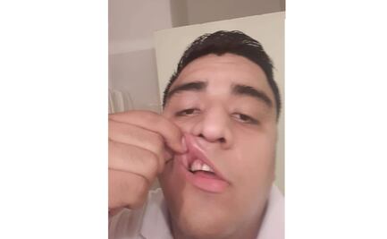 Hombre golpea a enfermero en Tamaulipas “por propagar” el Covid-19