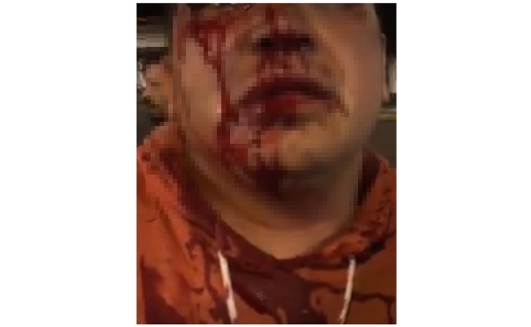 Foto: Periodista agredido. (Tomada del video: Cortesía Isidro Corro)
