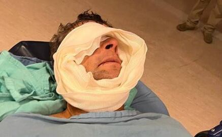 FOTOS: Así quedó Alfredo Adame tras cirugía: "Con un paracetamol quedo", dice