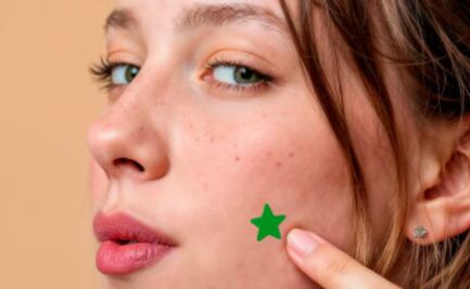 Esta es la solución de emergencia para los granitos