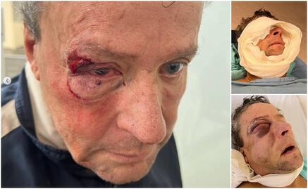 Alfredo Adame aún no puede salir del hospital; bromea con el aspecto de su rostro