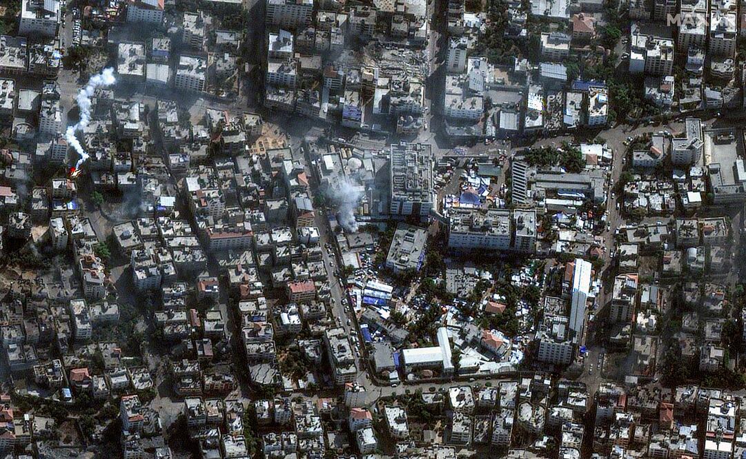 El hospital Al Shifa de la Ciudad de Gaza se encuentra en medio de la ofensiva terrestre israelí contra el movimiento islamista. Foto: AP