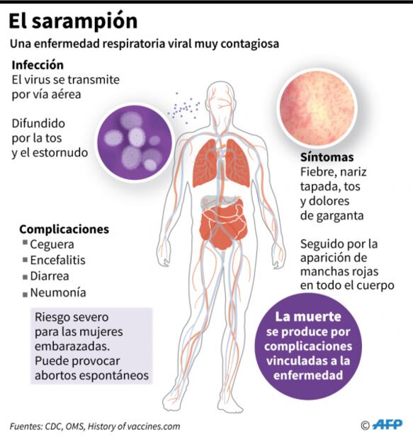 Nueva York ordena vacunación obligatoria para frenar epidemia de sarampión