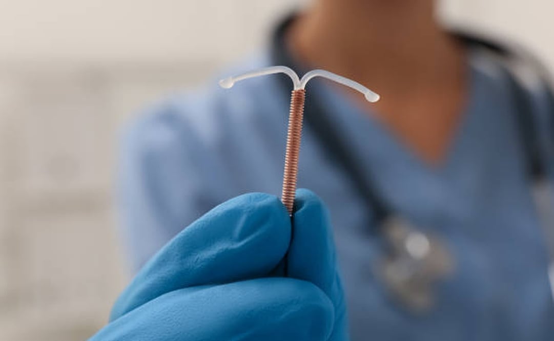 Los DIU, colocados en el útero, evitan que el esperma fertilice un óvulo. Foto: iStock