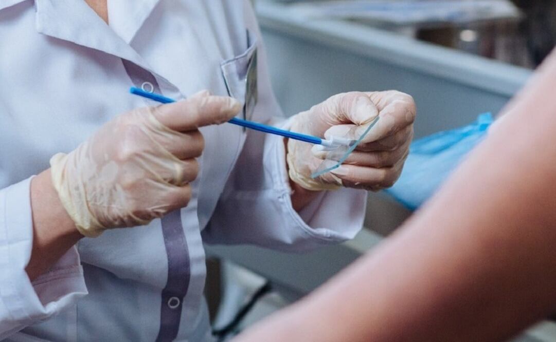 Álvaro Villegas explicó que a través del análisis de sangre o del Ácido Desoxirribonucleico (ADN), y en el caso de las mujeres mediante la prueba de papanicolaou, puede detectarse este problema y atenderlo a tiempo. Foto: Especial