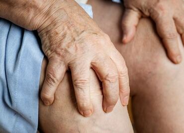 Aprende a preparar así la cebolla para disminuir el ácido úrico