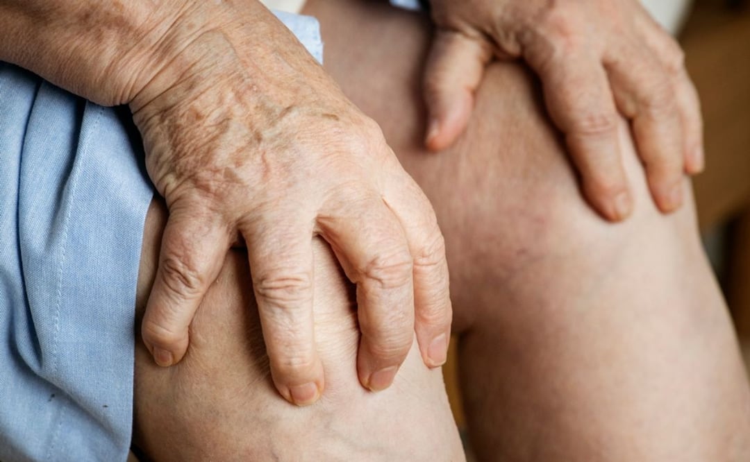 Cebolla para el ácido úrico. Fuente: Freepik