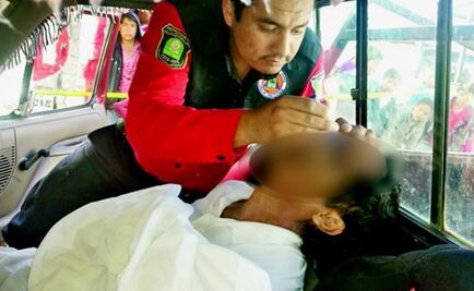 Ebrio muere al tragarse una abeja en Edomex