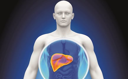 Identifican vínculo entre síndrome metabólico y cáncer hepático