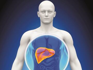Identifican vínculo entre síndrome metabólico y cáncer hepático