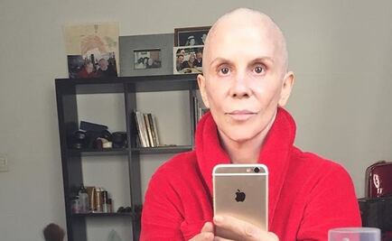 Rebecca Jones comparte fotos de lo que fue su lucha contra el cáncer 