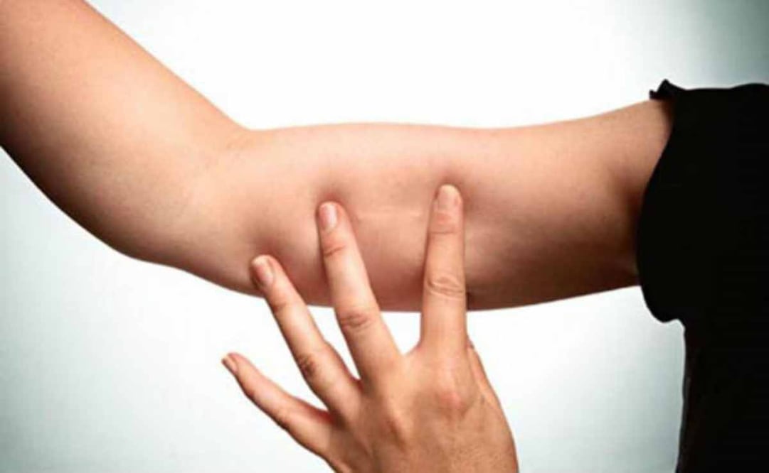 ONG obsequia implantes anticonceptivos a mujeres migrantes. Foto: iStock