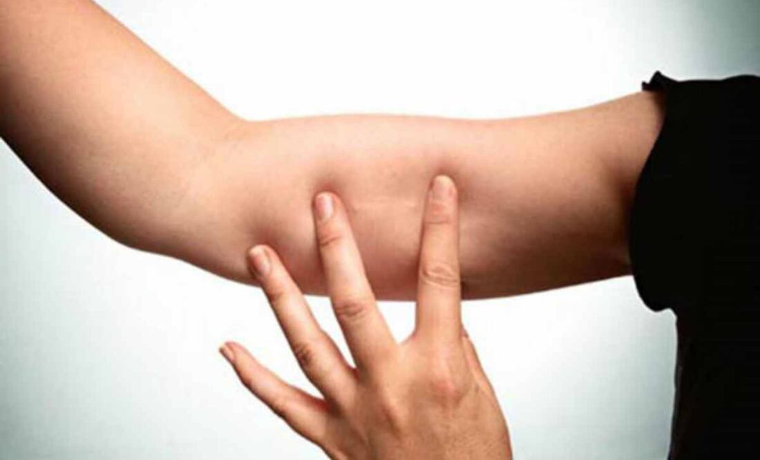 ONG obsequia implantes anticonceptivos a mujeres migrantes. Foto: iStock