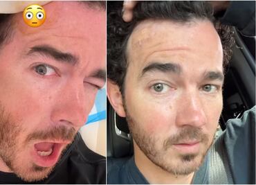 Lunar de Kevin Jonas, de los Jonas Brothers, resultó ser un tumor maligno