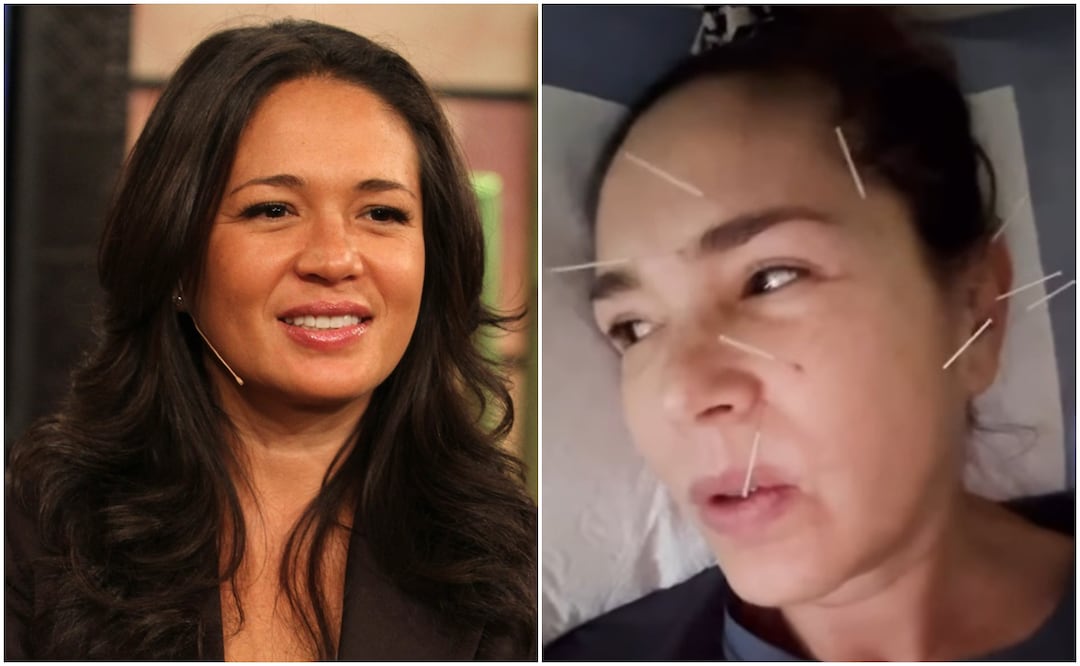 Yolanda Andrade comparte con sus seguidores imágenes de los efectos en su rostro de la Esclerosis Lateral Amiotrófica, los síntomas comenzaron en 2023.