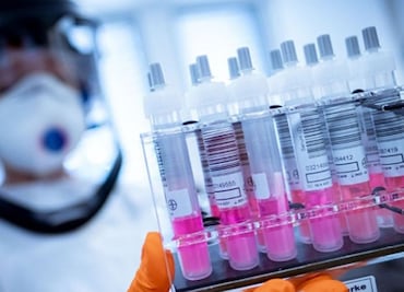 UNAM to start animal testing on COVID-19 vaccine