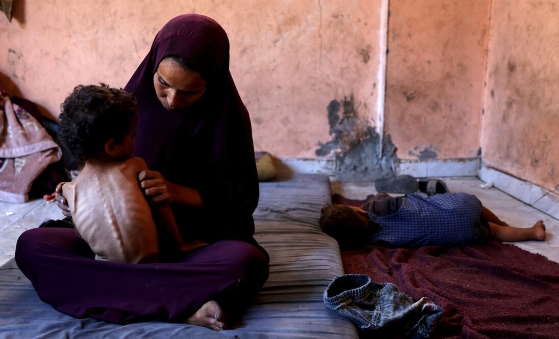 Naeema observa a su hijo Yazan, de 2 años, desnutrido, en el campo de refugiados de Al-Shati, en Gaza, el 23 de julio de 2025. Más de 100 organizaciones humanitarias y grupos de derechos humanos advirtieron el miércoles que la hambruna masiva se estaba extendiendo en Gaza. Foto: AFP