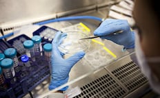 Trasplante de células madre logra curación de VIH; es el resultado de más de una década de investigación internacional