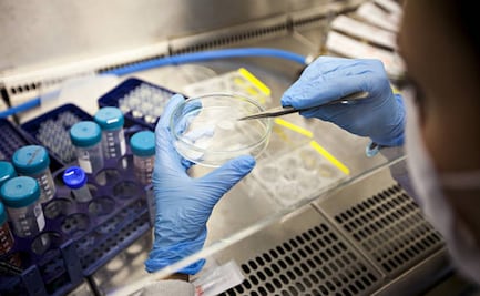 Trasplante de células madre logra curación de VIH; es el resultado de más de una década de investigación internacional