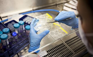 Trasplante de células madre logra curación de VIH; es el resultado de más de una década de investigación internacional