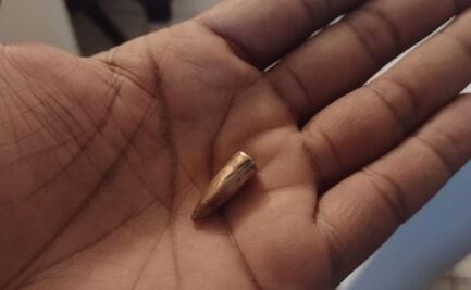 Bala perdida deja lesionada a una mujer en Nogales, Sonora