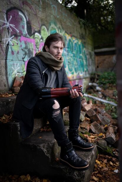 Esta prótesis biónica convierte a sus usuarios en un personaje de videojuegos