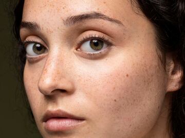 Cómo eliminar las manchas solares de la cara