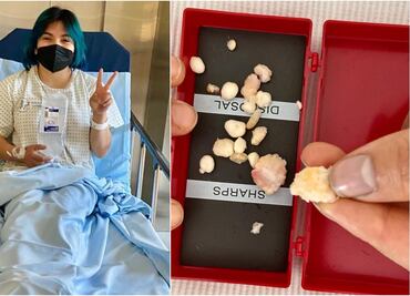 Alexa Moreno comparte en redes las "bellas creaciones óseas" que le quitaron de los pies