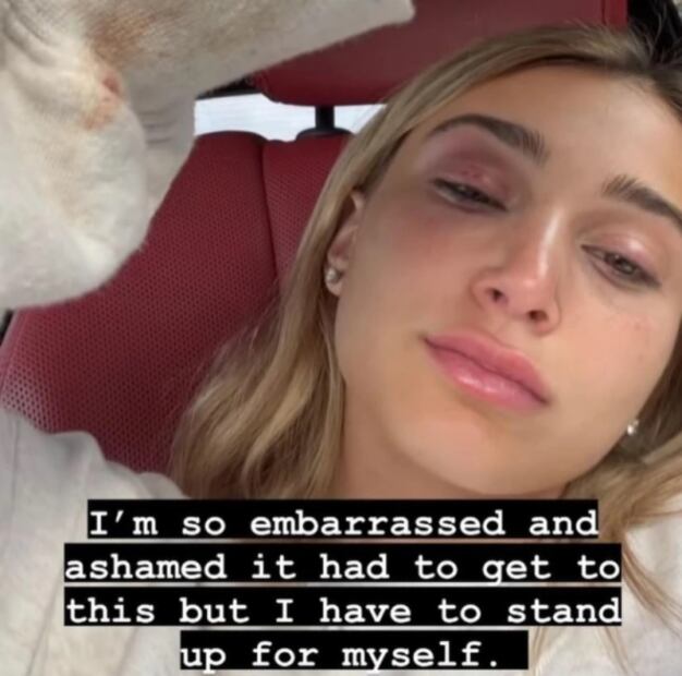 Arrestan al rapero Tyga luego de que su novia mostrara cómo la golpeó en el rostro