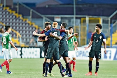 Dolorosa caída tricolor