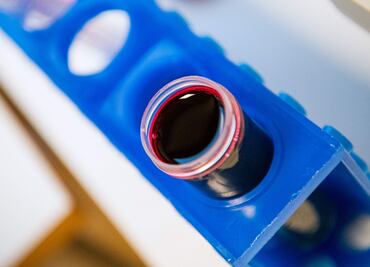 Con jugo de betabel, científicos producen sangre falsa para combatir al mosquito que transmite la malaria