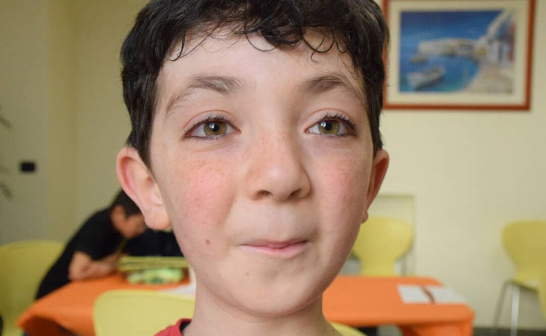 Los niños con síndrome de Kabuki tienen ojos grandes y almendrados. Foto: Asociación Italiana Síndrome de Kabuki