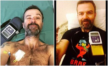 Pau Donés lucha contra el cáncer tras 11 quimioterapias