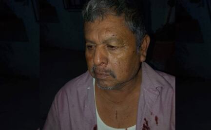 Sujetos armados golpean a líderes yaquis en Sonora; son trasladados al hospital