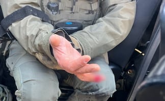 De una mordida, manifestante arranca dedo a agente en Minneapolis, acusan autoridades; Bondi informa que sujeto fue detenido