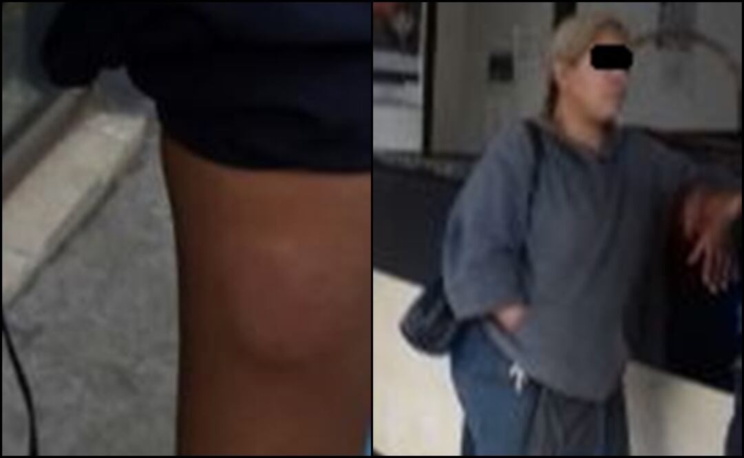 (Foto: SSP de la CDMX)