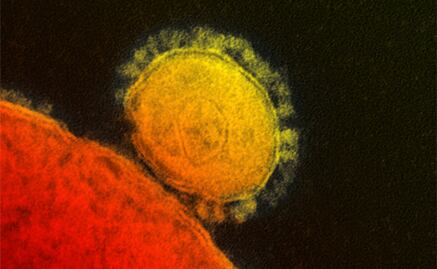 Covid-19: Científicos crean clon infectivo del coronavirus SARS-CoV-2