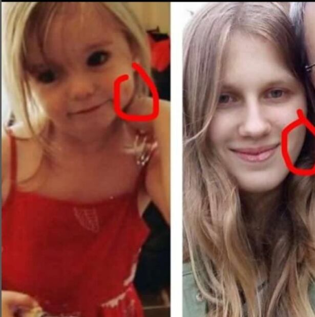 Madeleine McCann y la rara condición en el ojo que comparten la niña y la joven polaca