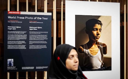 Retrato de un niño palestino amputado por la guerra en Gaza gana el World Press Photo; "una imagen silenciosa, pero habla muy fuerte"