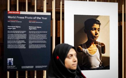 Retrato de un niño palestino amputado por la guerra en Gaza gana el World Press Photo; "una imagen silenciosa, pero habla muy fuerte"