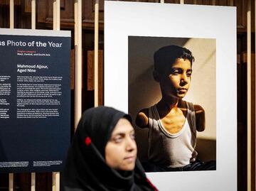 Retrato de un niño palestino amputado por la guerra en Gaza gana el World Press Photo; "una imagen silenciosa, pero habla muy fuerte"